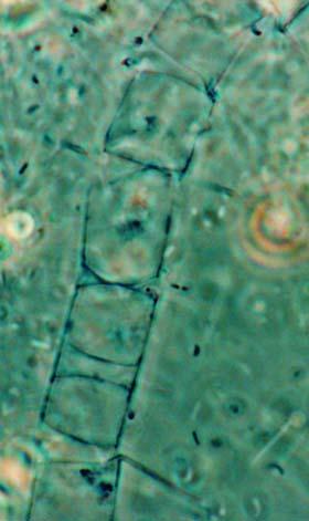 Protoperidinium sp. 1. Rhabdosphaera sp. 13. Scrippsiella sp. Eικ.169. Lichmorphora sp. (Ελ. Αμουτζοπούλου) Εικ.170.