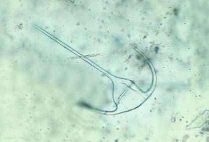 Ceratium furca (Ελ.