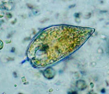 Ceratium sp. (Ελ.