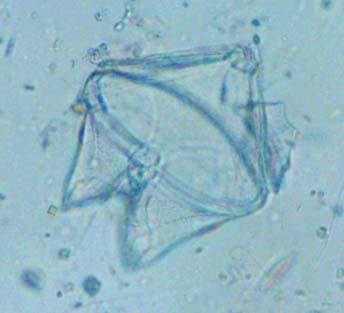 Prorocentrum micans (Ελ.