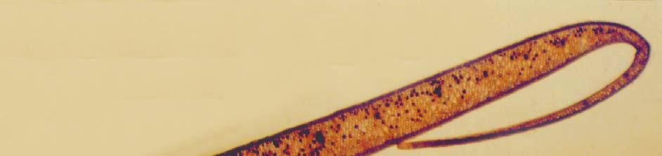 vascular bundle (nerve), 5.