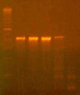 4 ΑΠΟΤΕΛΕΣΜΑΤΑ 4.1 ΑΠΟΤΕΛΕΣΜΑΤΑ PCR Για την επιβεβαίωση παρουσίας ιικού γενώματος στις κυτταροκαλλιέργειες πραγματοποιήθηκε PCR με το ζεύγος εκκινητών UG52/UC53 flap.