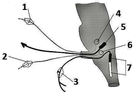 A B C D centrul nervos este localizat în coarnele anterioare neuronii căii aferente au prelungirile mielinizate efectorii sunt inervați de reflexul A este declanșat de stimuli chimici, iar reflexul B