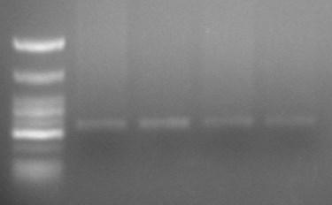 Διαδρομή 1: δείκτης μοριακών βαρών, DNA Ladder 50 bp. Διαδρομές 2-4: Ενίσχυση γενωμικού DNA των δειγμάτων 1 και 2. Διαδρομή 5: Δείγμα αρνητικού ελέγχου της αντίδρασης PCR. 3.