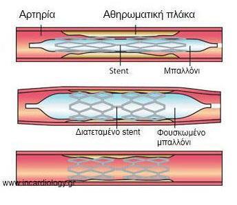 ΕΙΣΑΓΩΓΗ Η ροή του αίματος και η πίεση είναι μη μόνιμες, κυκλικά μεταβαλλόμενες χρονικές συναρτήσεις, λόγω της λειτουργίας του αντλητικού καρδιακού μηχανισμού και έχουν χαρακτηριστικές παλμικές