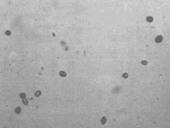 ΤΡΟΧΙΕΣ ΣΧΑΣΕΩΣ (Fission Tracks) 238 U = αυθόρμητη σχάση σε 96 Χ + 138 Υ Αυθόρμητη