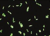 Svarīgi ir tas, ka fluorescences mikroskops ļauj redzēt tikai tās parauga daļas, kas spīd izvēlētajā viļņa garumu diapazonā.