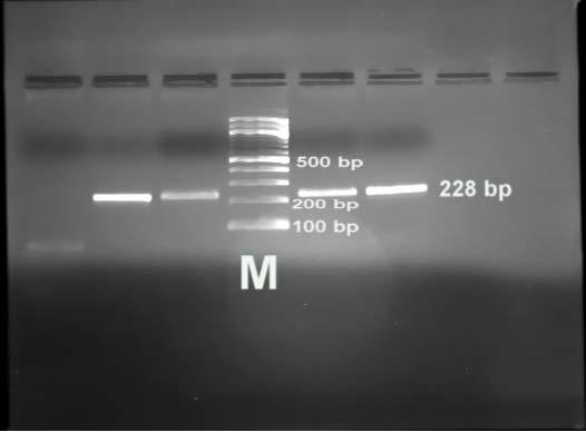 102 3.1.2 ΓΟΝΟΤΥΠΙΚΗ ΤΑΥΤΟΠΟΙΗΣΗ CTR 3.1.2.1 ΑΛΥΣΙΔΩΤΗ ΑΝΤΙΔΡΑΣΗ ΠΟΛΥΜΕΡΑΣΗΣ Πραγματοποιήθηκε PCR στα δείγματα DNA και υπήρξε επιτυχής σε όλα τα δείγματα.