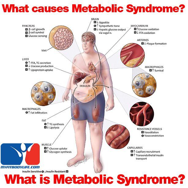 Reaven GM. (2005). The metabolic syndrome: requiescat in pace.