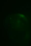 Β) Ενδεικτικές φωτογραφίες φθοριζόντων εμβρύων με το μικροσκόπιο φθορισμού.