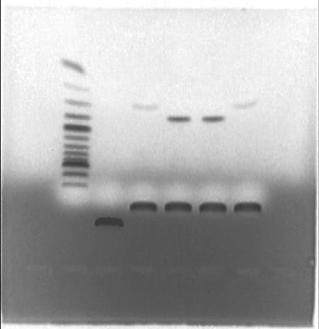 Αποτελέσματα Όπως φαίνεται στην εικόνα 3.16, από την τρίτη PCR αντίδραση, προέκυψε ειδικό προϊόν μεγέθους 400nt, όπως αναμενόταν (κόκκινο βέλος).