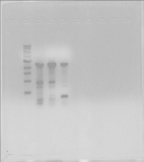 Αποτελέσματα Το προϊόν κλωνοποιήθηκε στον πλασμιδιακό φορέα pgem-teasy και ελέγχθηκε η παρουσία του ενθέματος σε εκατό κλώνους (10 δεκάδες) με PCR.
