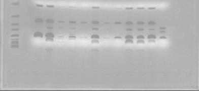 Αποτελέσματα Πραγματοποιήθηκαν τρεις αντιδράσεις RT- PCR χρησιμοποιώντας κλίσεις θερμοκρασιών (55 0 C, 58 0 C και 60 0 C) με στόχο την επίτευξη της πιο αποδοτικής υβριδοποίησης των εκκινητών.