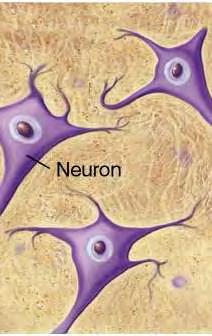 μεγάλα ποσά του πεπτιδίου Αμυλοειδούς β, τμήματα νευρικών και μη νευρικών κυττάρων (αστροκύτταρα, μικρογλοιακά). Η ανάπτυξη τους είναι σταδιακή και διαρκεί από μερικούς μήνες έως και χρόνια.