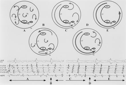 Hypothetical mechanism of ΑF organizing into typical