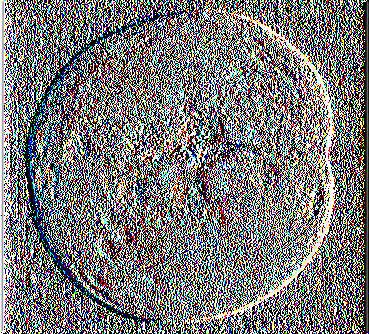 pentagona Εικ. 2.12.