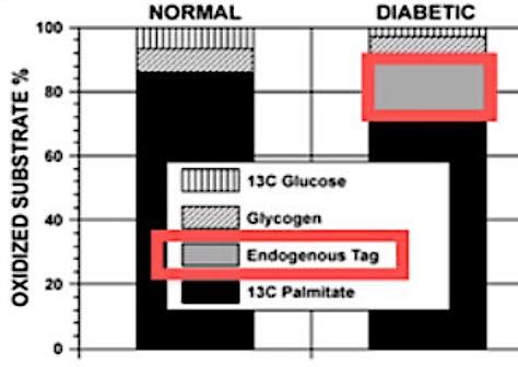 ± 65* Ηπατικό λίπος (λίπος/νερό) 1.1 ± 0.9 4.3 ± 5.2 8.3 ± 11.1* 8.