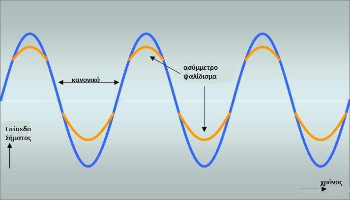 Εικόνα 5: ιάγραµµα overdrive επιπέδου σήµατος σε σχέση µε τον χρόνο Μια κοινή διακύµανση ονοµάζεται ασύµµετρο ψαλίδισµα, όπου η µία πλευρά της κυµατοµορφής ψαλιδίζεται