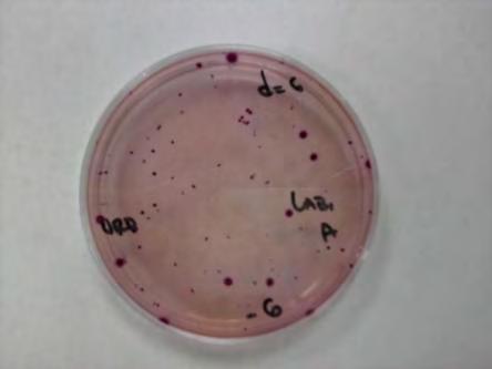 20 Εικόνα 2.6: Αποικίες Enterobacteriaceae σε θρεπτικό υπόστρωμα VRBGA. Η καταμέτρηση του βακτηρίου L.