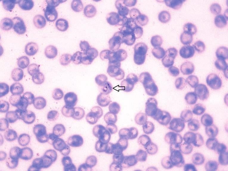 Εικόνα 5. Επίχρισμα αίματος σκύλου με πιροπλάσμωση. Παρατηρείται ένα ζεύγος από αχλαδόσχημους μεροζωίτες της Babesia canis (βέλος) εντός ερυθρού αιμοσφαιρίου (Χρώση Giemsa, 100x αντικειμενικό φακό).