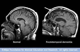 MRI in