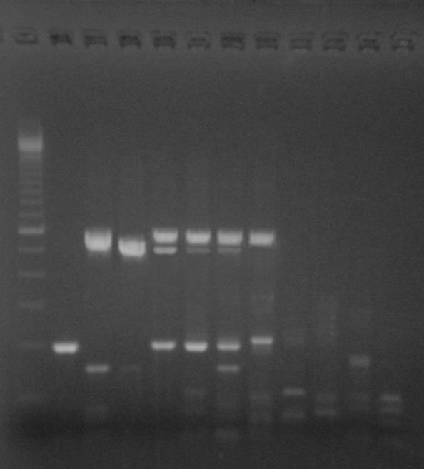 ΑΠΟΤΕΛΕΣΜΑΤΑ ΑΠΟΤΕΛΕΣΜΑΤΑ MULTIPLEX-PCR Group 2: Γενωμικές Περιοχές 2A 2C 3D Τύποι Ανα/σμού S1/S3 S3/S1 S2/S1 Εκκινητές 2A-S1/S3-S 2A-S1/S3-A 2C-S3/S1-S 2C-S3/S1-A 3D-S2/S1-S 3D-S2/S1-A Προϊόν (bp)