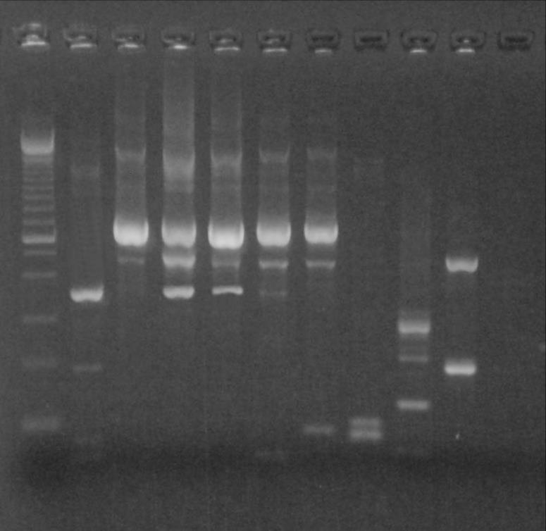 ΑΠΟΤΕΛΕΣΜΑΤΑ ΑΠΟΤΕΛΕΣΜΑΤΑ MULTIPLEX-PCR Group 3: Γενωμικές Περιοχές 3C 3D Τύποι Ανα/σμού S3/S2 S1/S2 Εκκινητές 3C-S3/S2-S 3C-S3/S2-A 3D-S1/S2-S 3D-S1/S2-A Προϊόν (bp) 327bp 714bp Θερμοκρασία