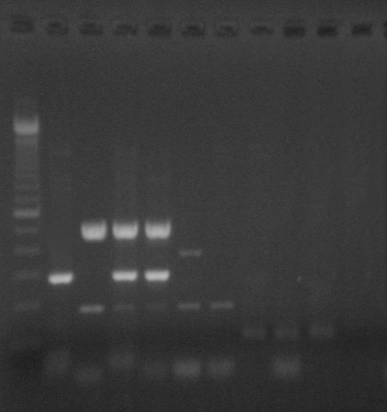 ΑΠΟΤΕΛΕΣΜΑΤΑ ΑΠΟΤΕΛΕΣΜΑΤΑ MULTIPLEX-PCR Group 4: Γενωμικές Περιοχές 3C 3D Τύποι Ανα/σμού S2/S1 S2/S1 Εκκινητές 3C-S2/S1-S 3C-S2/S1b-A 3D-S2/S1b-S 3D-S2/S1b-A Προϊόν (bp) 298bp 495bp Θερμοκρασία
