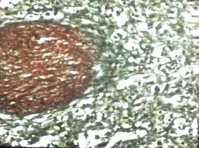 + 9a. Δικτυωτές ίνες (ρετικουλίνες) συνδετικού ιστού (είναι αργυρόφιλες) Συναντώνται σε κυτταροβριθή όργανα (π.χ.