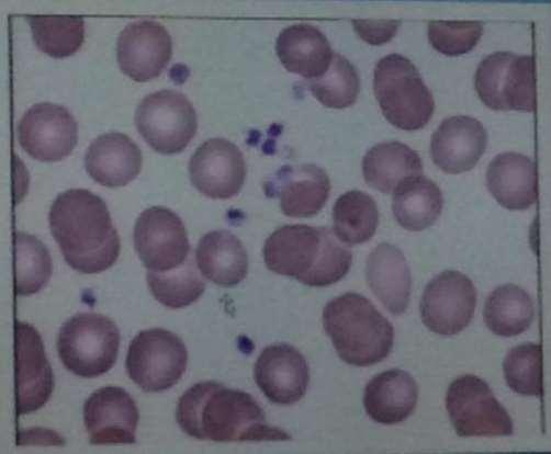 + 32. Ερυθρα αιμοσφαίρια & αιμοπετα λια Ερυθρά: κόκκινα απύρηνα και