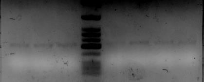 300 bp 200 bp 216 bp Εικϐνα 16: Ηλεκτροφϐρηςη ςε πόκτωμα αγαρϐζησ 2% των προώϐντων ενύςχυςησ τησ περιοχόσ που περιλαμβϊνει τα κωδικϐνια 12 και 13 του γονιδύου KRAS μετϊ απϐ τον καθαριςμϐ τουσ.
