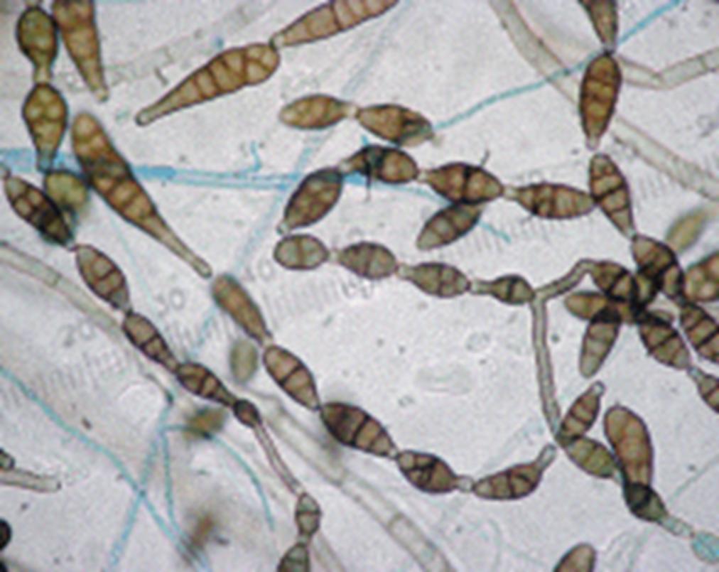 Alternaria alternata Κονίδια ηοσ μύκηηα ζε