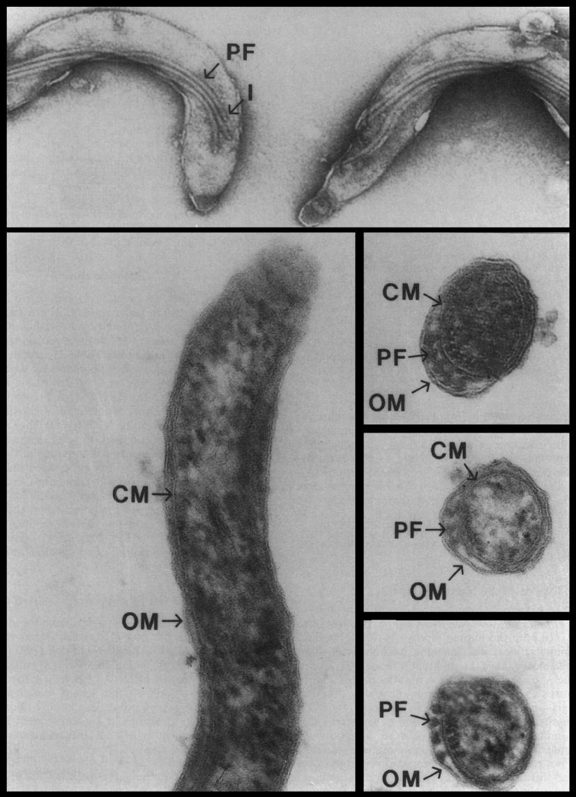 Σπειροχαίτη, βακτήριο με σπειροειδής σχήμα, έντονη κινητικότητα Treponema pallidum Διαθέτει εξωτερική μεμβράνη με πολύ χαρακτηριστική σύνθεση (Outer membrane, OM) Μαστίγια