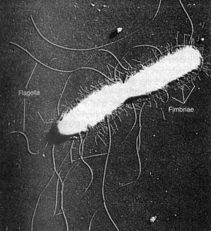 Gram αρνητικό, ραβδόμορφο (rod-shape) βακτήριο Salmonella enterica >2500 ορότυποι (serovals/serotypes) σύμφωνα με την ταξινόμηση κατά Κauffmann-White Δυο βασικές κατηγόριες ασθενειών: Α)