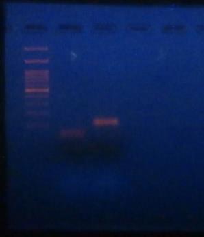 2. ΕΞΩΝΙΑ 7 (μέγεθος PCR προϊόντος 149 bp), 8 (μέγεθος PCR προϊόντος 592 bp), 9 (μέγεθος PCR προϊόντος 497 bp) 7 8 9 Τ Μ Εικόνα 15: Πήκτωμα αγαρόζης