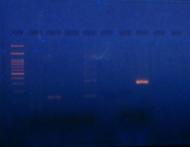4. ΕΞΩΝΙΟ 11 (μέγεθος PCR προϊόντος 284 bp) Μ T 11