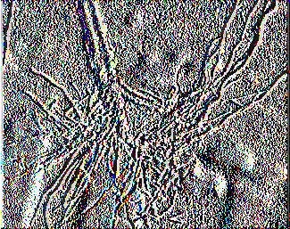 σήψη λαιμού και ριζών από Fusarium oxysporum β.