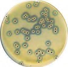 Εικόνα 8. Eκλεκτικό υπόστρωμα Baird Parker με αποικίες Staphylococcus aureus (Μακρυγιάννης 2011). 2.2.7.