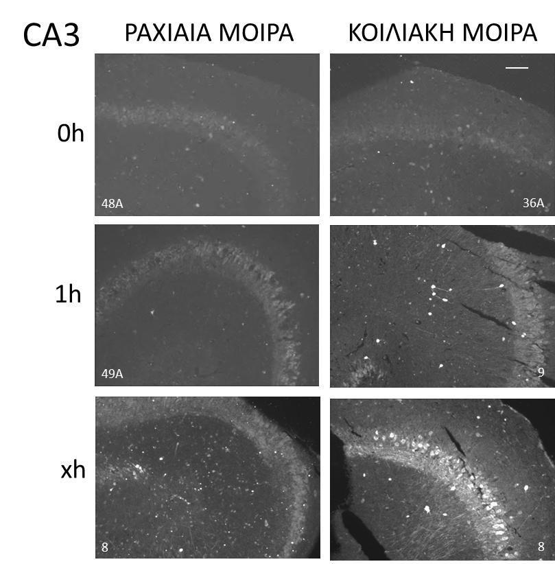 Εικόνα 16. Ανοσοϊστοχημικός εντοπισμός του GABA στη CA3 περιοχή σε τομές ιπποκάμπου της ραχιαίας και κοιλιακής μοίρας μετά από 0h, 1h και xh παραμονής σε ΤΕΝΥ.