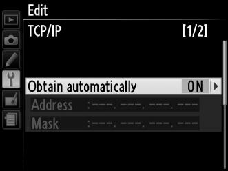 TCP/IP Αν το δίκτυο είναι διαμορφωμένο να παρέχει αυτόματα διευθύνσεις IP, επιλέξτε το Enable (Ενεργό) για το Obtain automatically (Απόκτηση αυτόματα).
