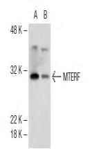 scbt.com/) MTERF (T-14) Antibody: sc-160543