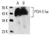 9) TFB2M: TFB2M antibody (ARP39549) 10) α-pdh mouse: PDH-E1α (9H9) Antibody: sc-65242 (Από http://www.scbt.com/) 11) mouse-igg, Rabbit-IgG: control για ανοσοκατακρήμνιση.