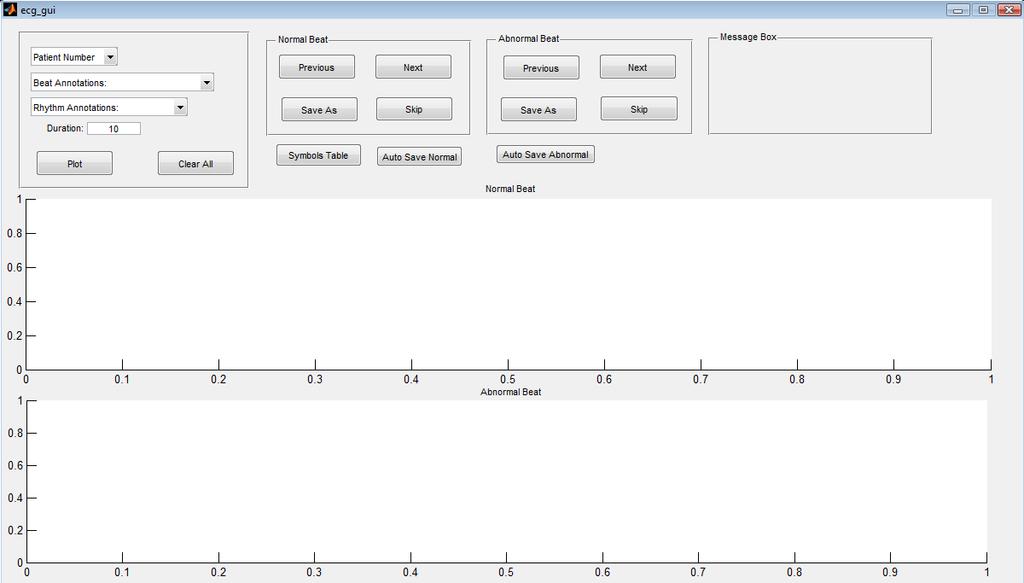 5.5 Data Annotation Graphical User Interface (GUI) Βασικό κομμάτι της παρούσας διπλωματικής ήταν η δημιουργία μίας βάσης δεδομένων με automatically annotated σήματα, τα οποία θα χωρίζονταν σε