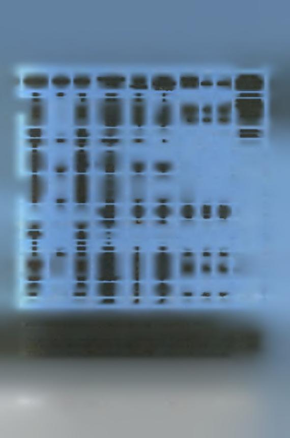 - S2 730 - S2 744 - S1 8029 5191 A G S1 3Β 580 5389 A T S2 IF - S2 ID - S2 730 - S2 744 - S1 8029 - S1 3C 580 5665 T c 5959 G A S2 IF - S2/S1 ID - S2 730 - S2 744 - S1 8029 5791 T C 5698 A c 87 Arg