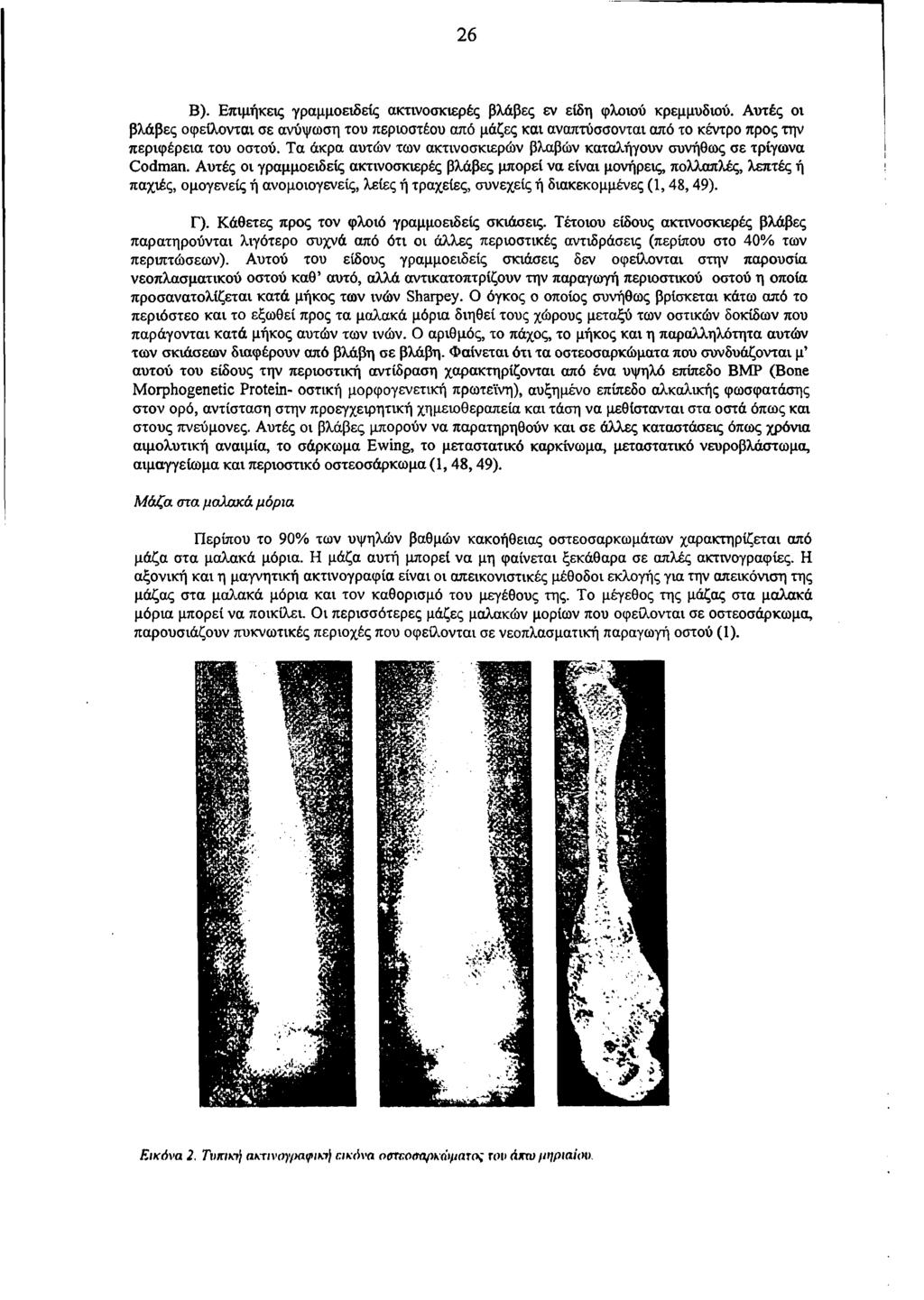 26 Β). Επιμήκεις γραμμοειδείς ακτινοσκιερές βλάβες εν είδη φλοιού κρεμμυδιού.