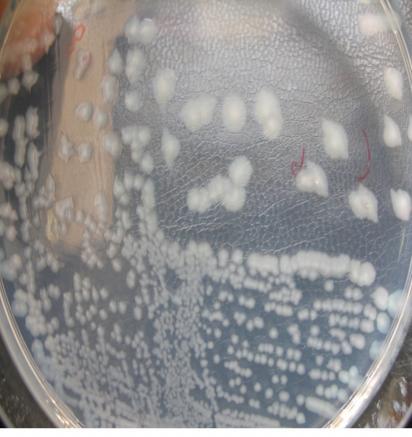 96 Well) με τα βακτηριακά στελέχη του D. solani P. carotovorum και P.