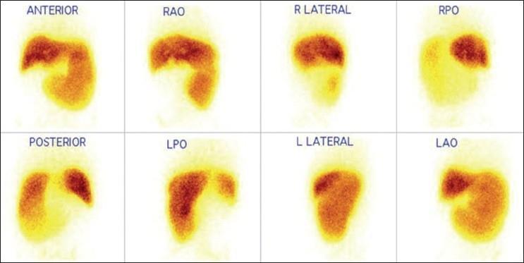 αιτιολογίας) Source: Chakraborty D, et al.