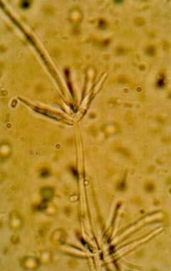 Verticillium dahliae Κονίδια