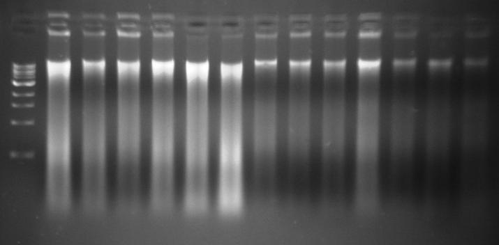ενδεικτικά ζώνες ορισμένων δειγμάτων DNA μετά από ηλεκτροφόρηση σε gel αγαρόζης 1% (Ladder