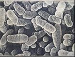 Το Γένος Propionibacterium 1/6 Gram (+) βάκιλλοι, ακίνητοι, μη σπορογόνοι Είδη του γένους Propionibacterium: P.